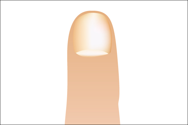 �����ŗV�Ԏ��̐g�����Ȃ݁I�ǂ�ȃG�`�P�b�g�ɒ��ӂ���΂����̂��H